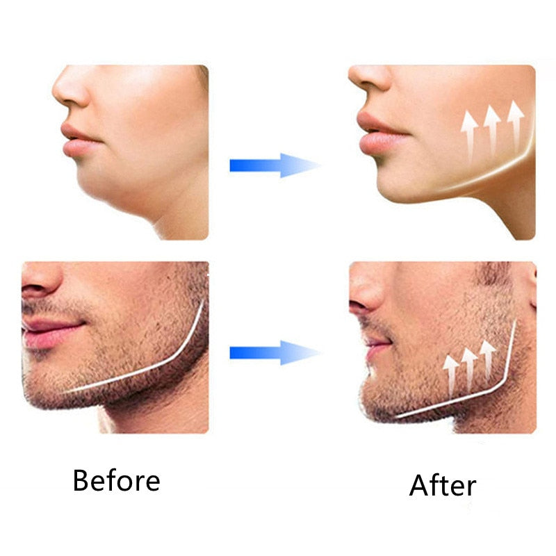 JAW FLEX (ejercitador de mandibula)